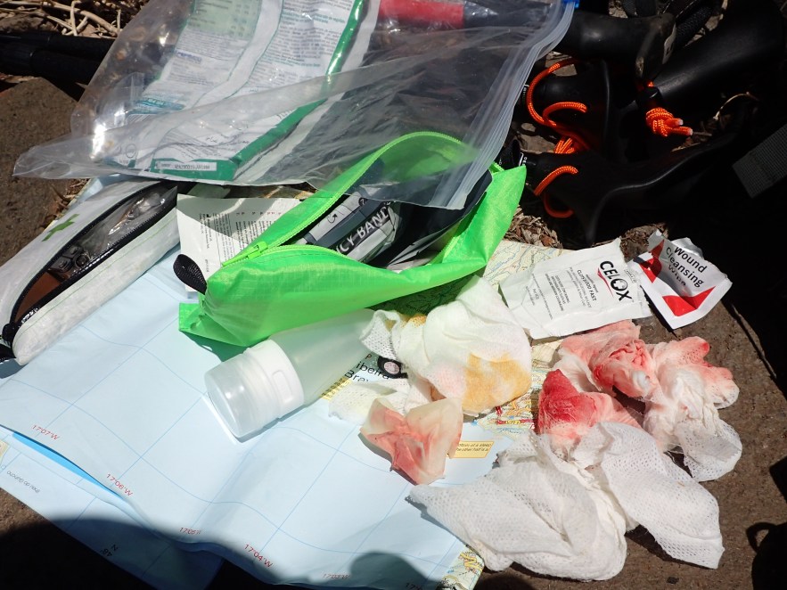 A handful of 1g compressed towlettes and soapy water sufficed in this instance to wash a wound on a hiking partner