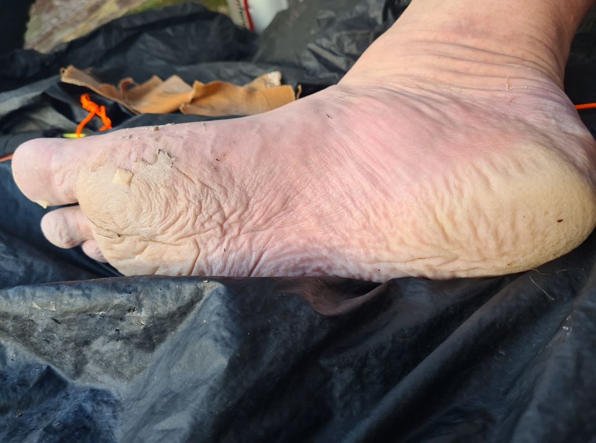 Cleaned foot in the evening