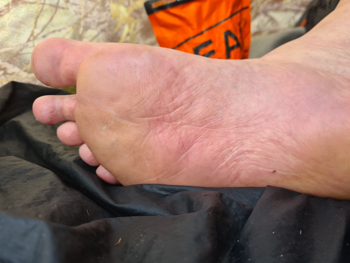 Refreshed foot in the morning